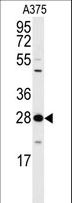 YWHAZ / 14-3-3 Zeta Antibody - Western blot of anti-14-3-3 protein zeta/delta Antibody (T232) in A375 cell line lysates (35 ug/lane). 14-3-3 (arrow) was detected using the purified antibody.