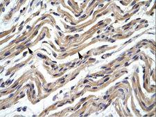 YY1 Antibody - YY1 antibody P100898_P050-NP_003394-YY1 (YY1 transcription factor) Antibody was used in IHC to stain formalin-fixed, paraffin-embedded human muscle.  This image was taken for the unconjugated form of this product. Other forms have not been tested.