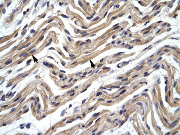 YY1 Antibody - YY1 antibody P100898_P050-NP_003394-YY1 (YY1 transcription factor) Antibody was used in IHC to stain formalin-fixed, paraffin-embedded human muscle.  This image was taken for the unconjugated form of this product. Other forms have not been tested.