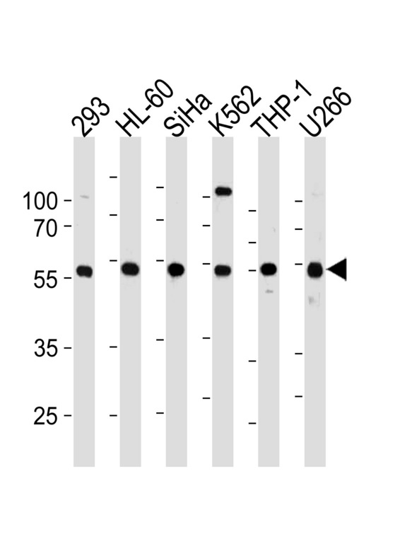 YY1 Antibody - YY1 Antibody (L89) western blot of 293,HL-60,SiHa,K562,THP-1,U266 cell line lysates (35 ug/lane). The YY1 antibody detected the YY1 protein (arrow).