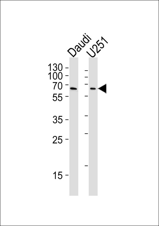 YY1 Antibody - YY1 Antibody western blot of Daudi and U251 cell line lysates (35 ug/lane). The YY1 antibody detected the YY1 protein (arrow).