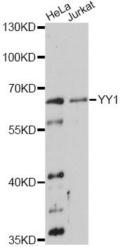 YY1 Antibody - Western blot analysis of extracts of various cell lines, using YY1 Antibody at 1:3000 dilution. The secondary antibody used was an HRP Goat Anti-Rabbit IgG (H+L) at 1:10000 dilution. Lysates were loaded 25ug per lane and 3% nonfat dry milk in TBST was used for blocking. An ECL Kit was used for detection and the exposure time was 10s.