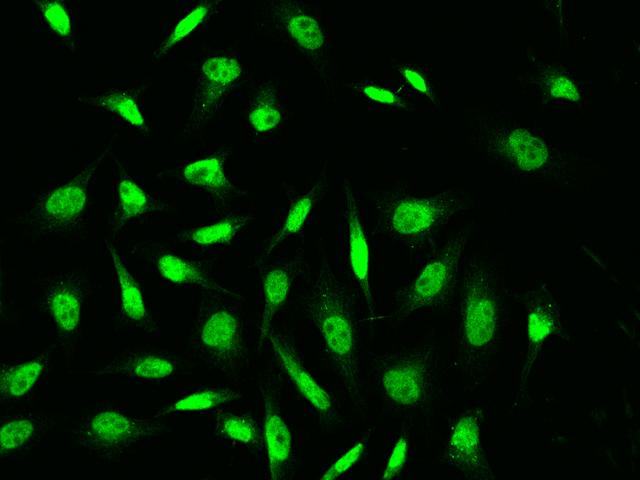 YY1 Antibody - Immunofluorescence staining of YY1 in HeLa cells. Cells were fixed with 4% PFA, permeabilzed with 0.1% Triton X-100 in PBS, blocked with 10% serum, and incubated with rabbit anti-Human YY1 polyclonal antibody (dilution ratio 1:1000) at 4°C overnight. Then cells were stained with the Alexa Fluor 488-conjugated Goat Anti-rabbit IgG secondary antibody (green).