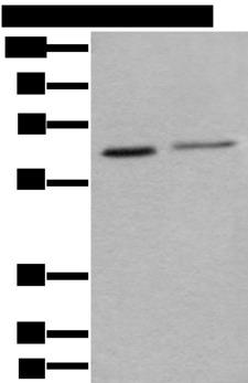 YY1 Antibody - Western blot analysis of Hela and A549 cell lysates  using YY1 Polyclonal Antibody at dilution of 1:400