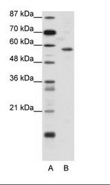 YY1 Antibody - A: Marker, B: Jurkat Cell Lysate.  This image was taken for the unconjugated form of this product. Other forms have not been tested.