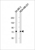 YY1AP1 Antibody - All lanes : Anti-YY1AP1 Antibody at 1:2000 dilution Lane 1: SK-BR-3 whole cell lysates Lane 2: MDA-MB-231 whole cell lysates Lysates/proteins at 20 ug per lane. Secondary Goat Anti-Rabbit IgG, (H+L), Peroxidase conjugated at 1/10000 dilution Predicted band size : 88 kDa Blocking/Dilution buffer: 5% NFDM/TBST.