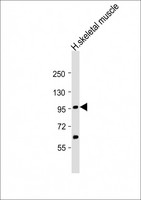 YY1AP1 Antibody - Anti-YY1AP1 Antibody at 1:2000 dilution + human skeletal muscle lysates Lysates/proteins at 20 ug per lane. Secondary Goat Anti-Rabbit IgG, (H+L), Peroxidase conjugated at 1/10000 dilution Predicted band size : 88 kDa Blocking/Dilution buffer: 5% NFDM/TBST.