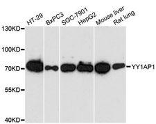 YY1AP1 Antibody - Western blot analysis of extracts of various cell lines, using YY1AP1 antibody at 1:3000 dilution. The secondary antibody used was an HRP Goat Anti-Rabbit IgG (H+L) at 1:10000 dilution. Lysates were loaded 25ug per lane and 3% nonfat dry milk in TBST was used for blocking. An ECL Kit was used for detection and the exposure time was 30s.