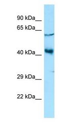 YY2 Antibody - YY2 antibody Western Blot of HCT15.  This image was taken for the unconjugated form of this product. Other forms have not been tested.