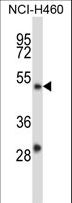 YY2 Antibody - YY2 Antibody western blot of NCI-H460 cell line lysates (35 ug/lane). The YY2 antibody detected the YY2 protein (arrow).