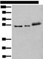 YY2 Antibody - Western blot analysis of Hela cell Mouse kidney tissue and Human colorectal cancer tissue lysates  using YY2 Polyclonal Antibody at dilution of 1:800