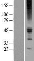 ZACN Protein - Western validation with an anti-DDK antibody * L: Control HEK293 lysate R: Over-expression lysate