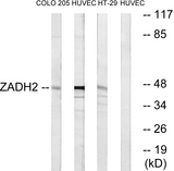 ZADH2 Antibody - Western blot analysis of lysates from HUVEC, HT-29, and COLO cells, using ZADH2 Antibody. The lane on the right is blocked with the synthesized peptide.