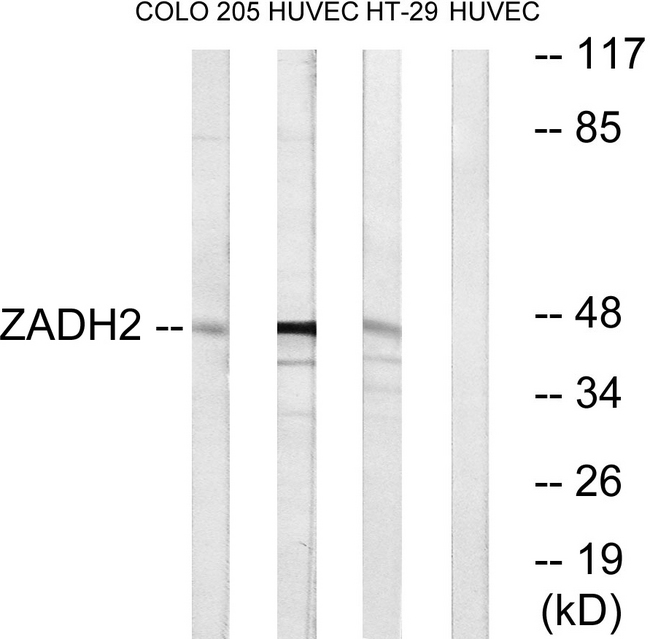 ZADH2 Antibody - Western blot analysis of lysates from HUVEC, HT-29, and COLO cells, using ZADH2 Antibody. The lane on the right is blocked with the synthesized peptide.