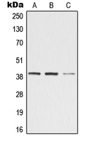 ZADH2 Antibody - Western blot analysis of ZADH2 expression in Jurkat (A); Raw264.7 (B); rat kidney (C) whole cell lysates.