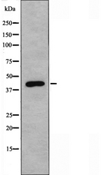 ZADH2 Antibody - Western blot analysis of extracts of COLO cells using ZADH2 antibody.