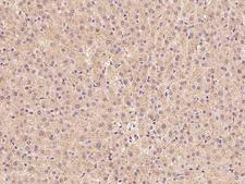 ZADH2 Antibody - Immunochemical staining of human ZADH2 in human liver with rabbit polyclonal antibody at 1:100 dilution, formalin-fixed paraffin embedded sections.