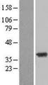 ZADH2 Protein - Western validation with an anti-DDK antibody * L: Control HEK293 lysate R: Over-expression lysate