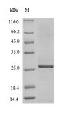 Measles Virus Large Polymerase Protein - (Tris-Glycine gel) Discontinuous SDS-PAGE (reduced) with 5% enrichment gel and 15% separation gel.