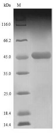 Nucleocapsid Protein Protein - (Tris-Glycine gel) Discontinuous SDS-PAGE (reduced) with 5% enrichment gel and 15% separation gel.