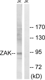 ZAK / MLTK Antibody - Western blot analysis of lysates from Jurkat cells, using ZAK Antibody. The lane on the right is blocked with the synthesized peptide.