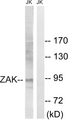 ZAK / MLTK Antibody - Western blot analysis of lysates from Jurkat cells, using ZAK Antibody. The lane on the right is blocked with the synthesized peptide.