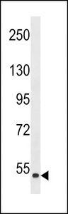 ZAK / MLTK Antibody - Western blot of anti-MLKLAK-C284 antibody in HepG2 cell line lysate (35 ug/lane). MLKLAK-C284(arrow) was detected using the purified antibody. This western blot detected isoform 2 of MLKLAK, the accession number for MLKLAK isoform 1 is Q9NYL2, NP_057737.