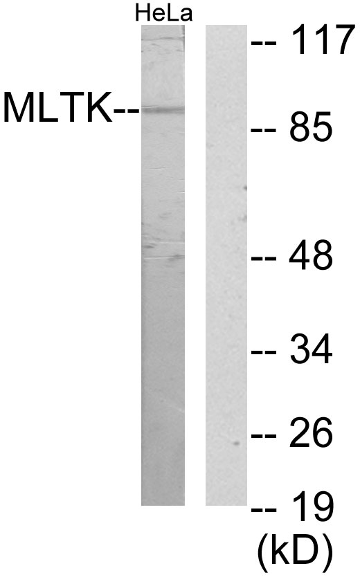 ZAK / MLTK Antibody - Western blot analysis of lysates from HeLa cells, using MLTK Antibody. The lane on the right is blocked with the synthesized peptide.