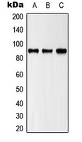 ZAK / MLTK Antibody - Western blot analysis of ZAK expression in HeLa (A); HepG2 (B); NIH3T3 (C) whole cell lysates.