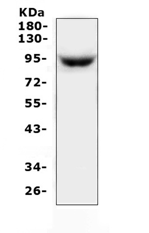 ZAK / MLTK Antibody - Western blot analysis of MAP3K20 using anti-MAP3K20 antibody. Electrophoresis was performed on a 5-20% SDS-PAGE gel at 70V (Stacking gel) / 90V (Resolving gel) for 2-3 hours. The sample well of each lane was loaded with 50ug of sample under reducing conditions. Lane 1: mouse thymus tissue lysate. After Electrophoresis, proteins were transferred to a Nitrocellulose membrane at 150mA for 50-90 minutes. Blocked the membrane with 5% Non-fat Milk/ TBS for 1.5 hour at RT. The membrane was incubated with rabbit anti-MAP3K20 antigen affinity purified polyclonal antibody at 0.5 µg/mL overnight at 4°C, then washed with TBS-0.1% Tween 3 times with 5 minutes each and probed with a goat anti-rabbit IgG-HRP secondary antibody at a dilution of 1:10000 for 1.5 hour at RT. The signal is developed using an Enhanced Chemiluminescent detection (ECL) kit with Tanon 5200 system. A specific band was detected for MAP3K20 at approximately 91KD. The expected band size for MAP3K20 is at 91KD.