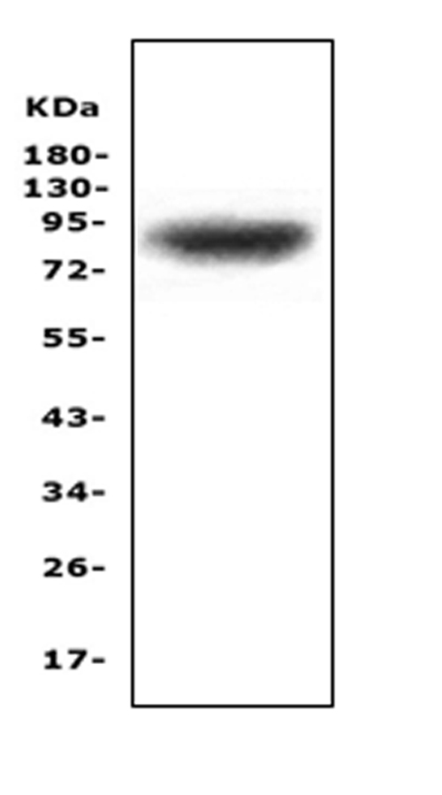 ZAK / MLTK Antibody - Western blot analysis of MAP3K20 using anti-MAP3K20 antibody. Electrophoresis was performed on a 5-20% SDS-PAGE gel at 70V (Stacking gel) / 90V (Resolving gel) for 2-3 hours. The sample well of each lane was loaded with 50ug of sample under reducing conditions. Lane 1: human PANC-1 whole cell lysates. After Electrophoresis, proteins were transferred to a Nitrocellulose membrane at 150mA for 50-90 minutes. Blocked the membrane with 5% Non-fat Milk/ TBS for 1.5 hour at RT. The membrane was incubated with rabbit anti-MAP3K20 antigen affinity purified polyclonal antibody at 0.5 µg/mL overnight at 4°C, then washed with TBS-0.1% Tween 3 times with 5 minutes each and probed with a goat anti-rabbit IgG-HRP secondary antibody at a dilution of 1:10000 for 1.5 hour at RT. The signal is developed using an Enhanced Chemiluminescent detection (ECL) kit with Tanon 5200 system. A specific band was detected for MAP3K20 at approximately 91KD. The expected band size for MAP3K20 is at 91KD.