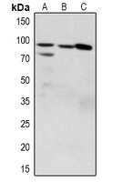 ZAK / MLTK Antibody - Western blot analysis of ZAK (pS165) expression in SGC7901 (A), HEK293T (B), HCT116 (C) whole cell lysates.