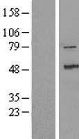 ZAK / MLTK Protein - Western validation with an anti-DDK antibody * L: Control HEK293 lysate R: Over-expression lysate