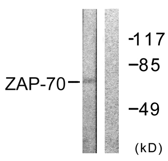 ZAP70 Antibody - Western blot analysis of lysates from 293 cells, treated with PMA 125ng/ml 30', using ZAP-70 Antibody. The lane on the right is blocked with the synthesized peptide.