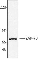 ZAP70 Antibody - Jurkat cell extract was resolved by electrophoresis, transferred to nitrocellulose, and probed with monoclonal anti-ZAP-70 antibody. Proteins were visualized using a goat anti-mouse secondary conjugated to HRP and a chemiluminescence detection system.