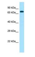 ZAP70 Antibody - ZAP70 antibody Western Blot of Mouse Kidney.  This image was taken for the unconjugated form of this product. Other forms have not been tested.