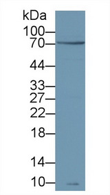 ZAP70 Antibody - Western Blot; Sample: Human Jurkat cell lysate; Primary Ab: 1µg/ml Rabbit Anti-Human zAP70 Antibody Second Ab: 0.2µg/mL HRP-Linked Caprine Anti-Rabbit IgG Polyclonal Antibody