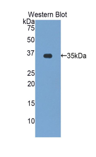 ZAP70 Antibody - Western blot of recombinant ZAP70.  This image was taken for the unconjugated form of this product. Other forms have not been tested.