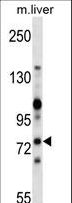 ZAP70 Antibody - Mouse Zap70 Antibody western blot of mouse liver tissue lysates (35 ug/lane). The Zap70 antibody detected the Zap70 protein (arrow).