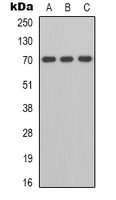 ZAP70 Antibody - Western blot analysis of ZAP70 expression in K562 (A); HepG2 (B); HeLa (C) whole cell lysates.