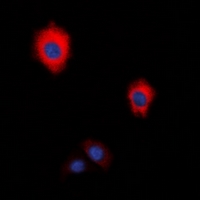 ZAP70 Antibody - Immunofluorescent analysis of ZAP70 staining in HeLa cells. Formalin-fixed cells were permeabilized with 0.1% Triton X-100 in TBS for 5-10 minutes and blocked with 3% BSA-PBS for 30 minutes at room temperature. Cells were probed with the primary antibody in 3% BSA-PBS and incubated overnight at 4 deg C in a humidified chamber. Cells were washed with PBST and incubated with a DyLight 594-conjugated secondary antibody (red) in PBS at room temperature in the dark. DAPI was used to stain the cell nuclei (blue).