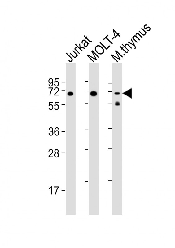 ZAP70 Antibody - All lanes : Anti-Zap70 Antibody at 1:2000 dilution Lane 1: Jurkat whole cell lysates Lane 2: MOLT-4 whole cell lysates Lane 3: mouse thymus lysates Lysates/proteins at 20 ug per lane. Secondary Goat Anti-Rabbit IgG, (H+L), Peroxidase conjugated at 1/10000 dilution Predicted band size : 70 kDa Blocking/Dilution buffer: 5% NFDM/TBST.