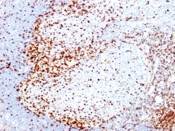 ZAP70 Antibody - Formalin-fixed, paraffin-embedded human tonsil stained with ZAP-70 antibody (2F3.2).  This image was taken for the unmodified form of this product. Other forms have not been tested.