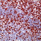 ZAP70 Antibody - Formalin-Fixed, paraffin-embedded human tonsil stained with peroxidase-conjugate and AEC chromogen. Note staining of T-Cells.