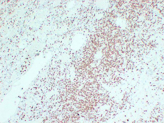 ZAP70 Antibody - Hodgkin'S Lymphoma 3