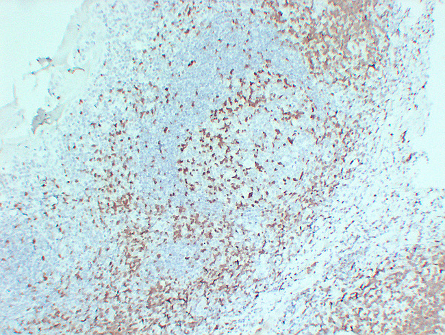 ZAP70 Antibody - Tonsil 3