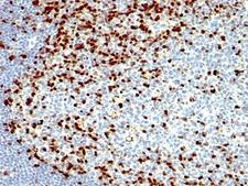 ZAP70 Antibody - Formalin-fixed, paraffin-embedded human tonsil stained with ZAP70 antibody (SPM362).  This image was taken for the unmodified form of this product. Other forms have not been tested.