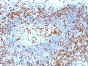 ZAP70 Antibody - IHC testing of FFPE human lymph node with ZAP70 antibody (clone ZAP70/2046). HIER: boil tissue sections in pH6, 10mM citrate buffer, for 10-20 min followed by cooling at RT for 20 min.
