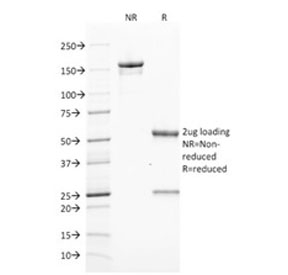 ZAP70 Antibody - SDS-PAGE analysis of purified, BSA-free ZAP70 antibody (clone ZAP70/2046) as confirmation of integrity and purity.