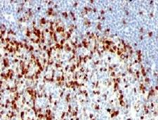 ZAP70 Antibody - Formalin-fixed, paraffin-embedded human tonsil stained with ZAP70 antibody (ZAP70/528 + 2F3.2).  This image was taken for the unmodified form of this product. Other forms have not been tested.